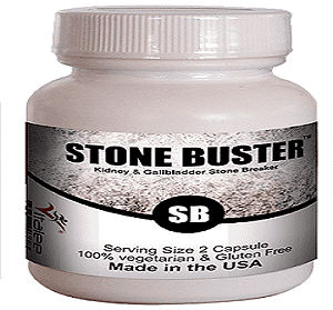 How to Prevent Kidney Stones – A Comprehensive Guide
